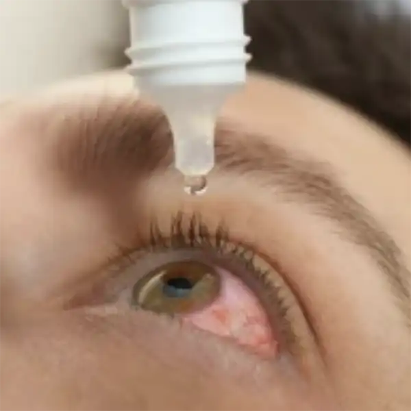 ยาหยอดตา (Eye Drops)
